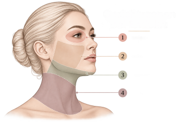Gesichtszonen Endolift