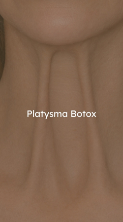 Platysma Botox